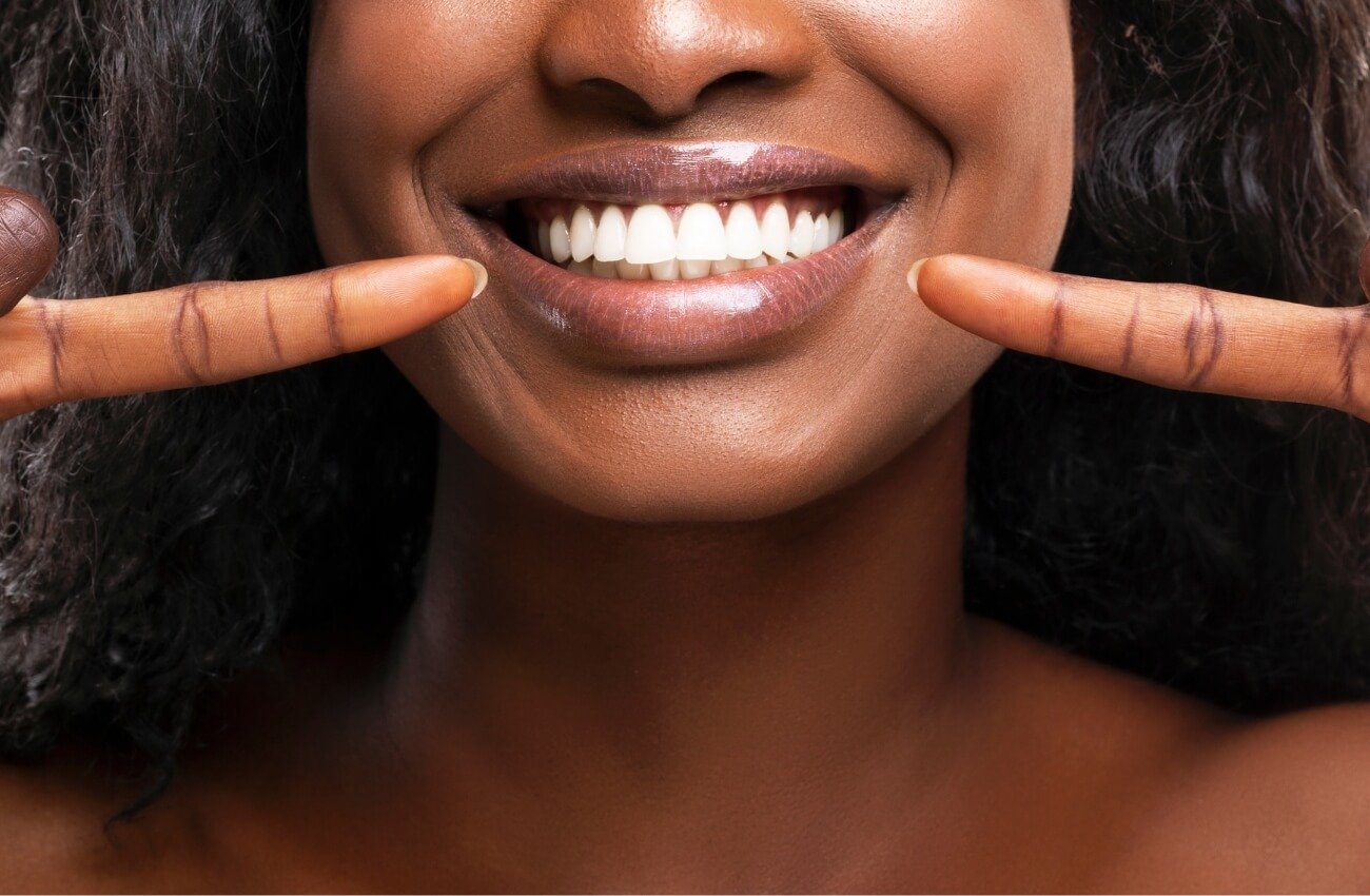 Hormones and Dental Health - Black Woman Smiling Pointing at White Teeth